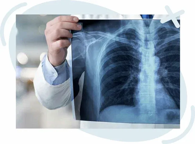 Medical professional holding a chest X‑ray film up to the light in a hospital setting.